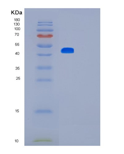 SDS-PAGE analysis of Human LMX1B (Lim Homeobox Transcription Factor 1-Beta) - Recombinant Protein, showing >90% purity under 15% SDS-PAGE (Reduced)