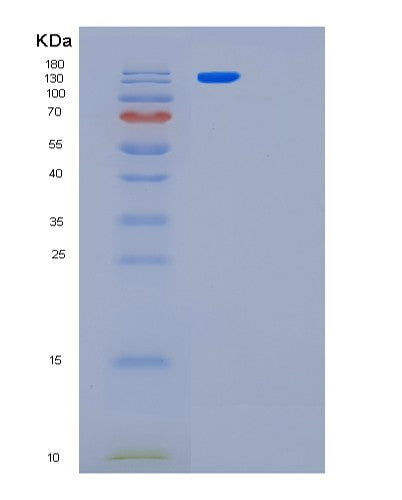 SDS-PAGE analysis of Human LRRC59 (Leucine-Rich Repeat-Containing Protein 59) - Recombinant Protein, showing >95% purity under 15% SDS-PAGE (Reduced)