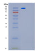 SDS-PAGE analysis of Human LRRC59 (Leucine-Rich Repeat-Containing Protein 59) - Recombinant Protein, showing >95% purity under 15% SDS-PAGE (Reduced)