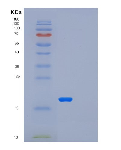 SDS-PAGE analysis of Human LSM1 (U6 Snrna-Associated Sm-Like Protein Lsm1) - Recombinant Protein, showing >90% purity under 15% SDS-PAGE (Reduced)