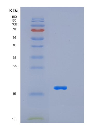 SDS-PAGE analysis of Human LSM4 (U6 Snrna-Associated Sm-Like Protein Lsm4) - Recombinant Protein, showing >90% purity under 15% SDS-PAGE (Reduced)