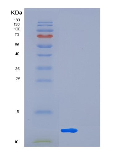 SDS-PAGE analysis of Human LSM5 (U6 Snrna-Associated Sm-Like Protein Lsm5) - Recombinant Protein, showing >85% purity under 15% SDS-PAGE (Reduced)
