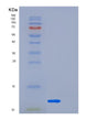 SDS-PAGE analysis of Human LSM5 (U6 Snrna-Associated Sm-Like Protein Lsm5) - Recombinant Protein, showing >85% purity under 15% SDS-PAGE (Reduced)