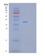 SDS-PAGE analysis of Human MAGEA8 (Melanoma-Associated Antigen 8) - Recombinant Protein, showing >90% purity under 15% SDS-PAGE (Reduced)