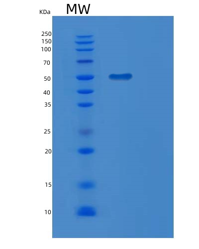 SDS-PAGE analysis of Human MGAT2 (Alpha-1,6-Mannosyl-Glycoprotein 2-Beta-N-Acetylglucosaminyltransferase) - Recombinant Protein, CAT# BLT-08389P showing >85% purity under 15% SDS-PAGE (Reduced)