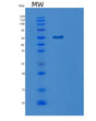 SDS-PAGE analysis of Human MGAT2 (Alpha-1,6-Mannosyl-Glycoprotein 2-Beta-N-Acetylglucosaminyltransferase) - Recombinant Protein, CAT# BLT-08389P showing >85% purity under 15% SDS-PAGE (Reduced)