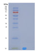 SDS-PAGE analysis of Human MLANA (Melanoma Antigen Recognized By T-Cells 1) - Recombinant Protein, showing >95% purity under 15% SDS-PAGE (Reduced)