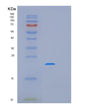 SDS-PAGE analysis of Human MRPS25 (Small Ribosomal Subunit Protein Ms25) - Recombinant Protein, showing >90% purity under 15% SDS-PAGE (Reduced)