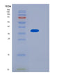 SDS-PAGE analysis of Human MTHFD2 (Bifunctional Methylenetetrahydrofolate Dehydrogenase/Cyclohydrolase, Mitochondrial) - Recombinant Protein, showing >95% purity under 15% SDS-PAGE (Reduced)