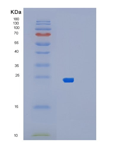 SDS-PAGE analysis of Human BLOC1S5 (Biogenesis Of Lysosome-Related Organelles Complex 1 Subunit 5) - Recombinant Protein, showing >85% purity under 15% SDS-PAGE (Reduced)