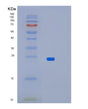 SDS-PAGE analysis of Human BLOC1S5 (Biogenesis Of Lysosome-Related Organelles Complex 1 Subunit 5) - Recombinant Protein, showing >85% purity under 15% SDS-PAGE (Reduced)