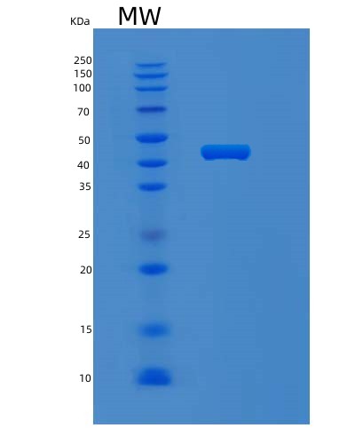 SDS-PAGE analysis of Human MVK (Mevalonate Kinase) - Recombinant Protein, showing >95% purity under 15% SDS-PAGE (Reduced)