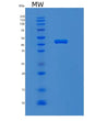 SDS-PAGE analysis of Human MVK (Mevalonate Kinase) - Recombinant Protein, showing >95% purity under 15% SDS-PAGE (Reduced)