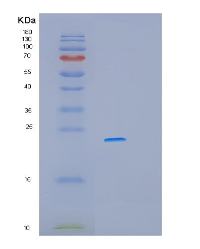 SDS-PAGE analysis of Human MYL11 (Myosin Regulatory Light Chain 11) - Recombinant Protein, showing >85% purity under 15% SDS-PAGE (Reduced)