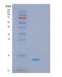 SDS-PAGE analysis of Human MYOZ1 (Myozenin-1) - Recombinant Protein, showing >95% purity under 15% SDS-PAGE (Reduced)