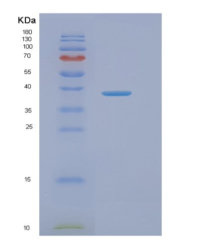 SDS-PAGE analysis of Human NAGK (N-Acetyl-D-Glucosamine Kinase) - Recombinant Protein, showing >95% purity under 15% SDS-PAGE (Reduced)
