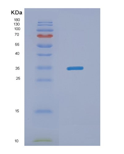 SDS-PAGE analysis of Human NANOG (Homeobox Protein Nanog) - Recombinant Protein, showing >90% purity under 15% SDS-PAGE (Reduced)