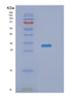 SDS-PAGE analysis of Human NANP (N-Acylneuraminate-9-Phosphatase) - Recombinant Protein, showing >95% purity under 15% SDS-PAGE (Reduced)