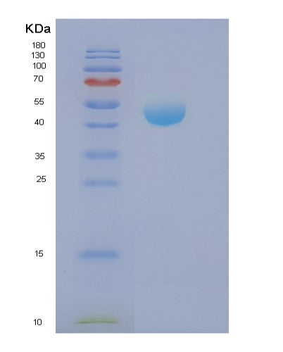 SDS-PAGE analysis of Human NCK2 (Cytoplasmic Protein Nck2) - Recombinant Protein, showing >85% purity under 15% SDS-PAGE (Reduced)