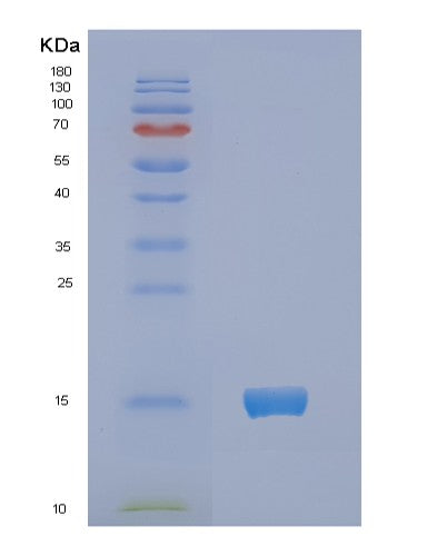 SDS-PAGE analysis of Human NCR3 - Recombinant Protein, showing >95% purity under 15% SDS-PAGE (Reduced)