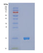 SDS-PAGE analysis of Human NCR3 - Recombinant Protein, showing >95% purity under 15% SDS-PAGE (Reduced)