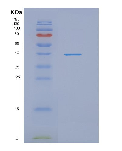 SDS-PAGE analysis of Human NDRG1 (Protein Ndrg1) - Recombinant Protein, showing >90% purity under 15% SDS-PAGE (Reduced)