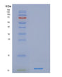 SDS-PAGE analysis of Human NDUFA4 (Cytochrome C Oxidase Subunit Ndufa4) - Recombinant Protein, showing >85% purity under 15% SDS-PAGE (Reduced)
