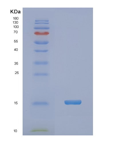 SDS-PAGE analysis of Human NDUFA5 (Nadh Dehydrogenase [Ubiquinone] 1 Alpha Subcomplex Subunit 5) - Recombinant Protein, showing >95% purity under 15% SDS-PAGE (Reduced)