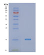 SDS-PAGE analysis of Human NDUFA5 (Nadh Dehydrogenase [Ubiquinone] 1 Alpha Subcomplex Subunit 5) - Recombinant Protein, showing >95% purity under 15% SDS-PAGE (Reduced)