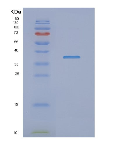 SDS-PAGE analysis of Human NDUFAF1 (Complex I Intermediate-Associated Protein 30, Mitochondrial) - Recombinant Protein, showing >90% purity under 15% SDS-PAGE (Reduced)
