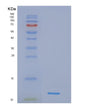 SDS-PAGE analysis of Human NDUFB4 (Nadh Dehydrogenase [Ubiquinone] 1 Beta Subcomplex Subunit 4) - Recombinant Protein, showing >95% purity under 15% SDS-PAGE (Reduced)