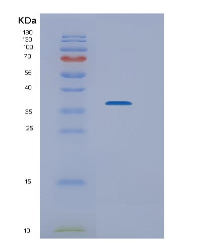 SDS-PAGE analysis of Human NEK7 (Serine/Threonine-Protein Kinase Nek7) - Recombinant Protein, showing >85% purity under 15% SDS-PAGE (Reduced)