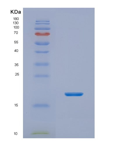 SDS-PAGE analysis of Human NHP2 (H/Aca Ribonucleoprotein Complex Subunit 2) - Recombinant Protein, showing >85% purity under 15% SDS-PAGE (Reduced)