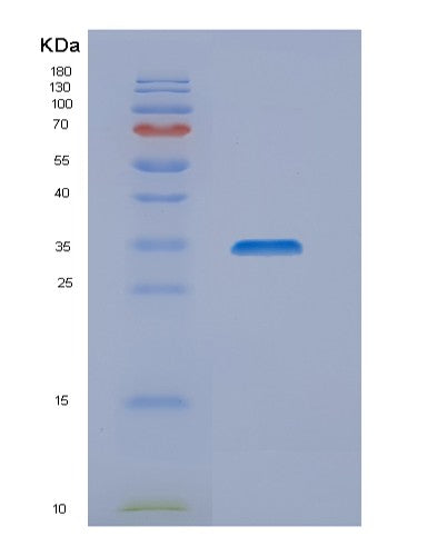SDS-PAGE analysis of Human METTL17 (Ribosome Assembly Protein Mettl17, Mitochondrial) - Recombinant Protein, showing >85% purity under 15% SDS-PAGE (Reduced)