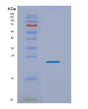 SDS-PAGE analysis of Human NKIRAS1 (Nf-Kappa-B Inhibitor-Interacting Ras-Like Protein 1) - Recombinant Protein, showing >90% purity under 15% SDS-PAGE (Reduced)