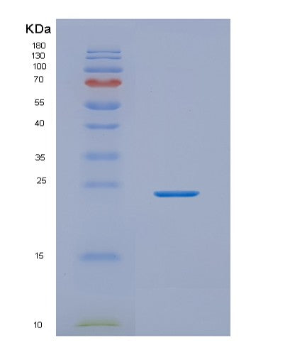 SDS-PAGE analysis of Human NKIRAS2 (Nf-Kappa-B Inhibitor-Interacting Ras-Like Protein 2) - Recombinant Protein, showing >85% purity under 15% SDS-PAGE (Reduced)
