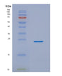 SDS-PAGE analysis of Human NKIRAS2 (Nf-Kappa-B Inhibitor-Interacting Ras-Like Protein 2) - Recombinant Protein, showing >85% purity under 15% SDS-PAGE (Reduced)