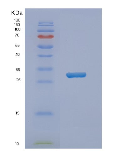 SDS-PAGE analysis of Human NKX3-1 (Homeobox Protein Nkx-3.1) - Recombinant Protein, showing >95% purity under 15% SDS-PAGE (Reduced)