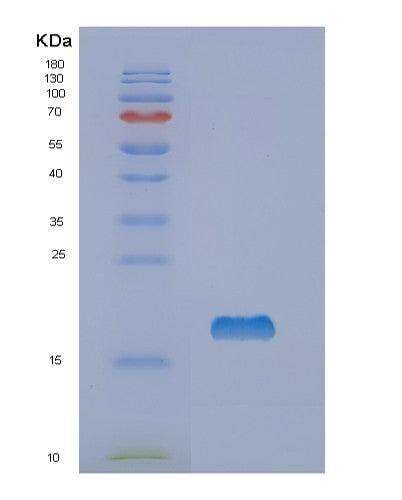 SDS-PAGE analysis of Human NME1 (Nucleoside Diphosphate Kinase A) - Recombinant Protein, showing >95% purity under 15% SDS-PAGE (Reduced)