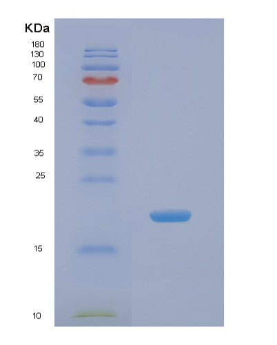 SDS-PAGE analysis of Human NME3 (Nucleoside Diphosphate Kinase 3) - Recombinant Protein, showing >85% purity under 15% SDS-PAGE (Reduced)