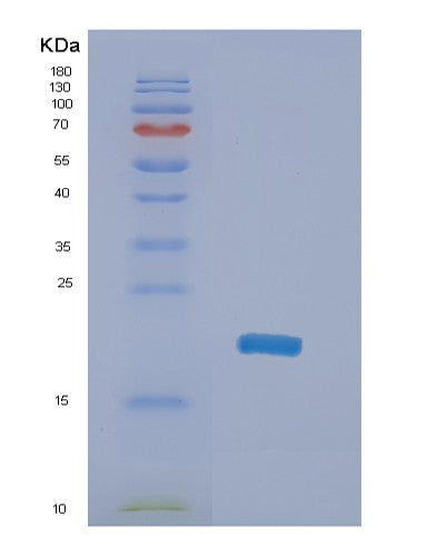 SDS-PAGE analysis of Human NME4 (Nucleoside Diphosphate Kinase, Mitochondrial) - Recombinant Protein, showing >90% purity under 15% SDS-PAGE (Reduced)
