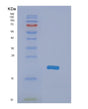 SDS-PAGE analysis of Human NME4 (Nucleoside Diphosphate Kinase, Mitochondrial) - Recombinant Protein, showing >90% purity under 15% SDS-PAGE (Reduced)