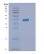 SDS-PAGE analysis of Human NMI (N-Myc-Interactor) - Recombinant Protein, showing >85% purity under 15% SDS-PAGE (Reduced)