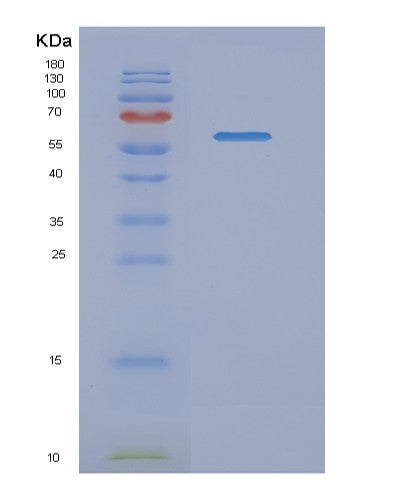 SDS-PAGE analysis of Human NMT1 (Glycylpeptide N-Tetradecanoyltransferase 1) - Recombinant Protein, showing >90% purity under 15% SDS-PAGE (Reduced)