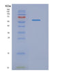 SDS-PAGE analysis of Human NMT1 (Glycylpeptide N-Tetradecanoyltransferase 1) - Recombinant Protein, showing >90% purity under 15% SDS-PAGE (Reduced)
