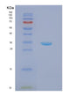 SDS-PAGE analysis of Human NPM1 (Nucleophosmin) - Recombinant Protein, showing >90% purity under 15% SDS-PAGE (Reduced)