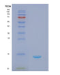 SDS-PAGE analysis of Human NPPC (C-Type Natriuretic Peptide) - Recombinant Protein, showing >95% purity under 15% SDS-PAGE (Reduced)