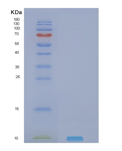 SDS-PAGE analysis of Human NRG4 (Pro-Neuregulin-4, Membrane-Bound Isoform) - Recombinant Protein, showing >90% purity under 15% SDS-PAGE (Reduced)