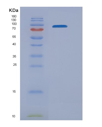 SDS-PAGE analysis of Mouse Nrp1 (Neuropilin-1) - Recombinant Protein, showing >90% purity under 15% SDS-PAGE (Reduced)