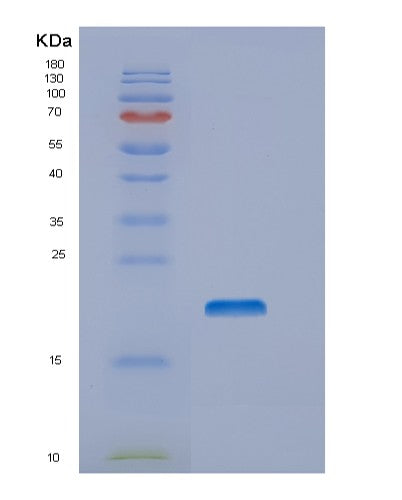 SDS-PAGE analysis of Human NTS (Neurotensin/Neuromedin N) - Recombinant Protein, showing >85% purity under 15% SDS-PAGE (Reduced)